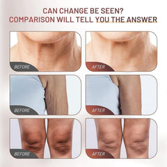 Lightweight non-greasy cream absorbs quickly on skin